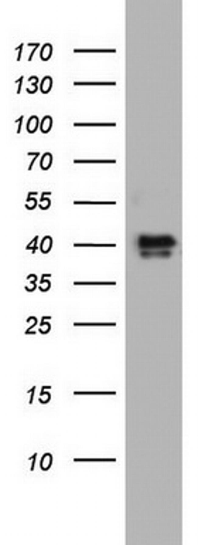 NRBF2 Antibody in Western Blot (WB)