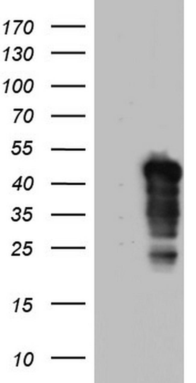 NRBF2 Antibody in Western Blot (WB)