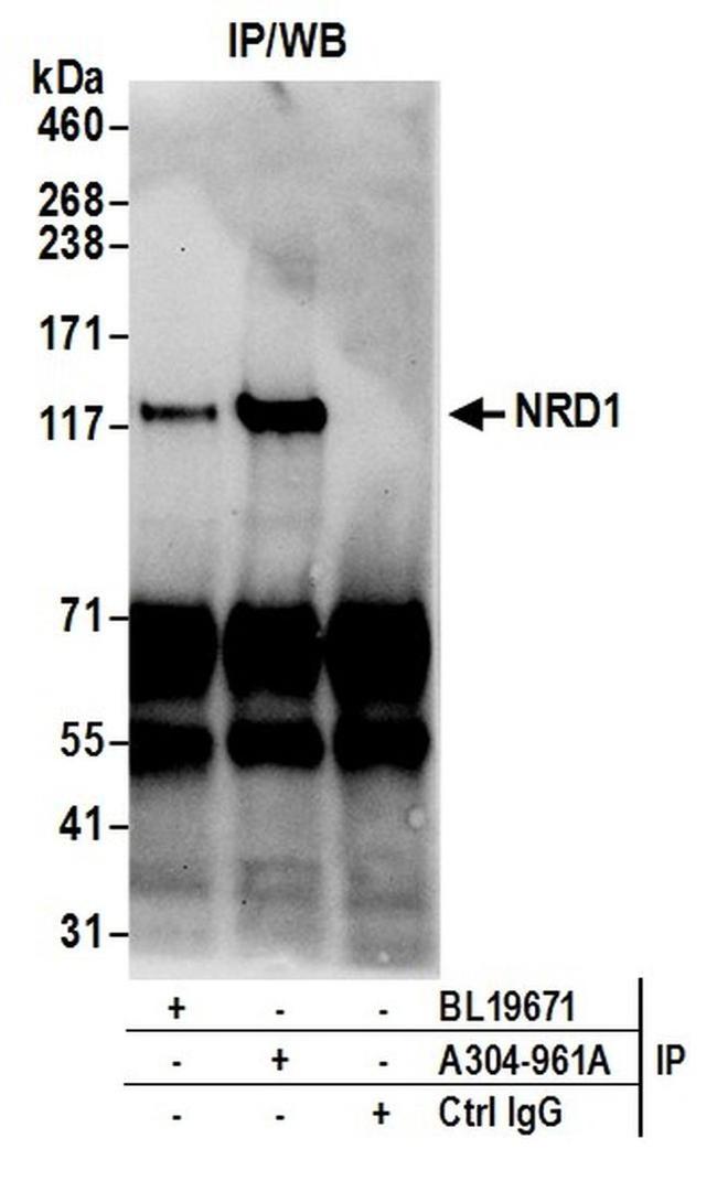 NRD1/Nardilysin Antibody in Western Blot (WB)