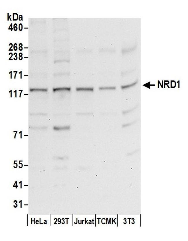 NRD1/Nardilysin Antibody in Western Blot (WB)