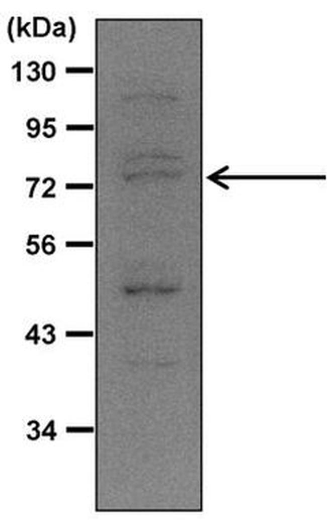 Nrf2 Antibody in Western Blot (WB)