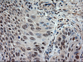 NT3 Antibody in Immunohistochemistry (Paraffin) (IHC (P))