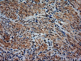 NT3 Antibody in Immunohistochemistry (Paraffin) (IHC (P))