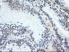 NT3 Antibody in Immunohistochemistry (Paraffin) (IHC (P))