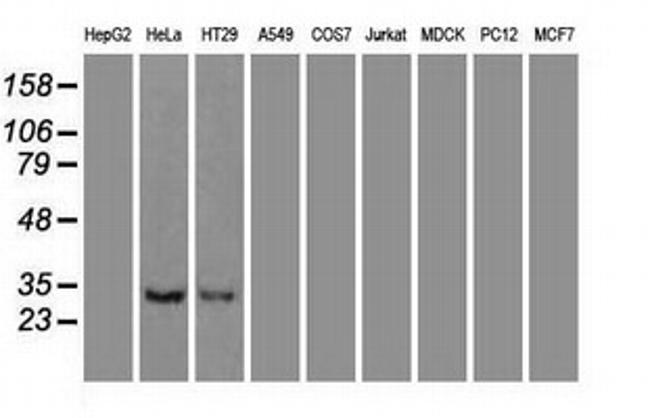 NT3 Antibody in Western Blot (WB)