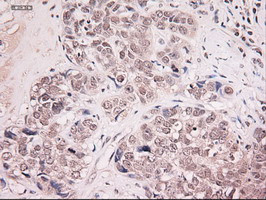 NT4 Antibody in Immunohistochemistry (Paraffin) (IHC (P))