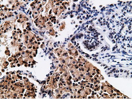 NT5DC1 Antibody in Immunohistochemistry (Paraffin) (IHC (P))