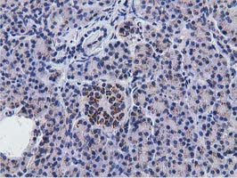 NT5DC1 Antibody in Immunohistochemistry (Paraffin) (IHC (P))