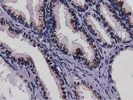 NT5DC1 Antibody in Immunohistochemistry (Paraffin) (IHC (P))