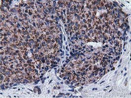 NT5DC1 Antibody in Immunohistochemistry (Paraffin) (IHC (P))