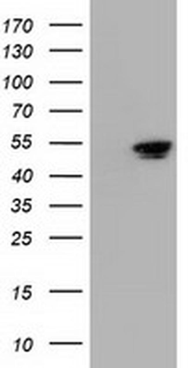 NT5DC1 Antibody in Western Blot (WB)