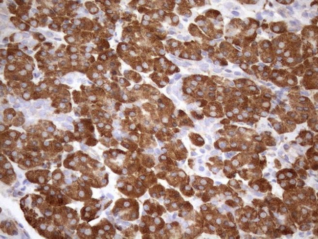 NT5E Antibody in Immunohistochemistry (Paraffin) (IHC (P))