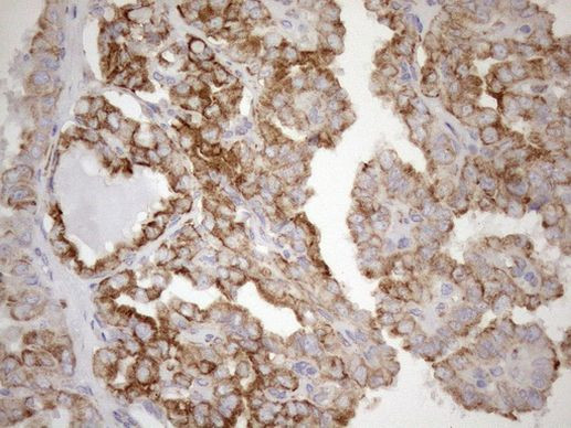 NT5E Antibody in Immunohistochemistry (Paraffin) (IHC (P))