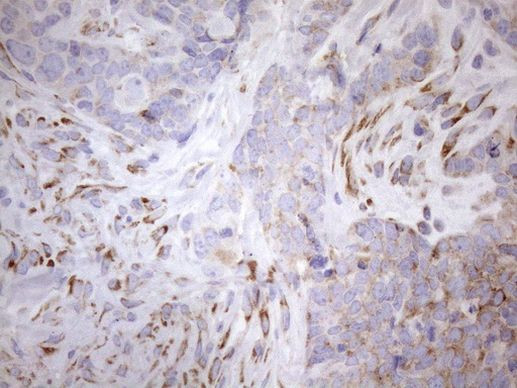 NT5E Antibody in Immunohistochemistry (Paraffin) (IHC (P))