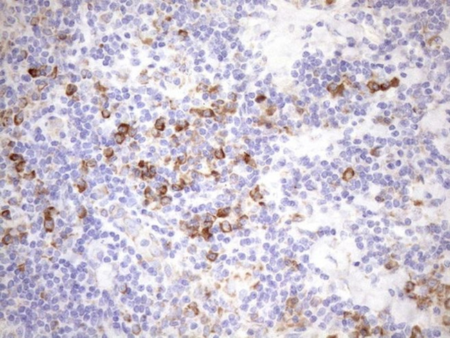 NT5E Antibody in Immunohistochemistry (Paraffin) (IHC (P))