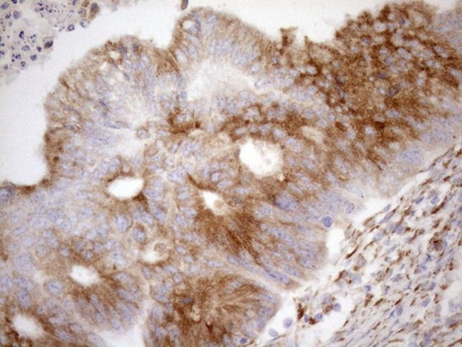 NT5E Antibody in Immunohistochemistry (Paraffin) (IHC (P))