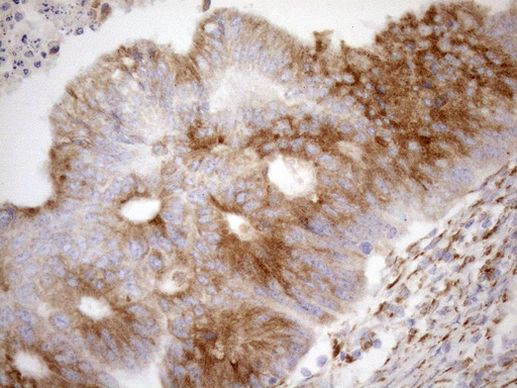 NT5E Antibody in Immunohistochemistry (Paraffin) (IHC (P))