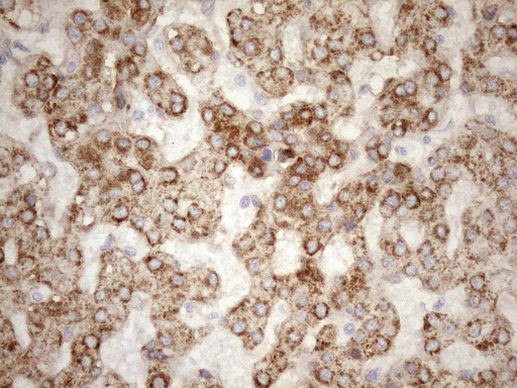 NT5E Antibody in Immunohistochemistry (Paraffin) (IHC (P))