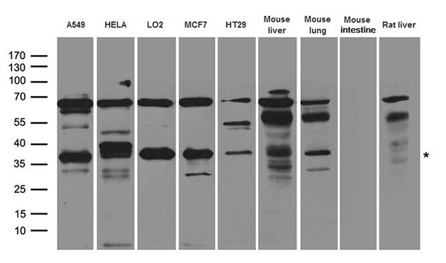 NTHL1 Antibody in Western Blot (WB)