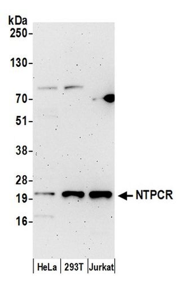 NTPCR Antibody in Western Blot (WB)