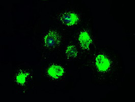 NTRK2 Antibody in Immunocytochemistry (ICC/IF)