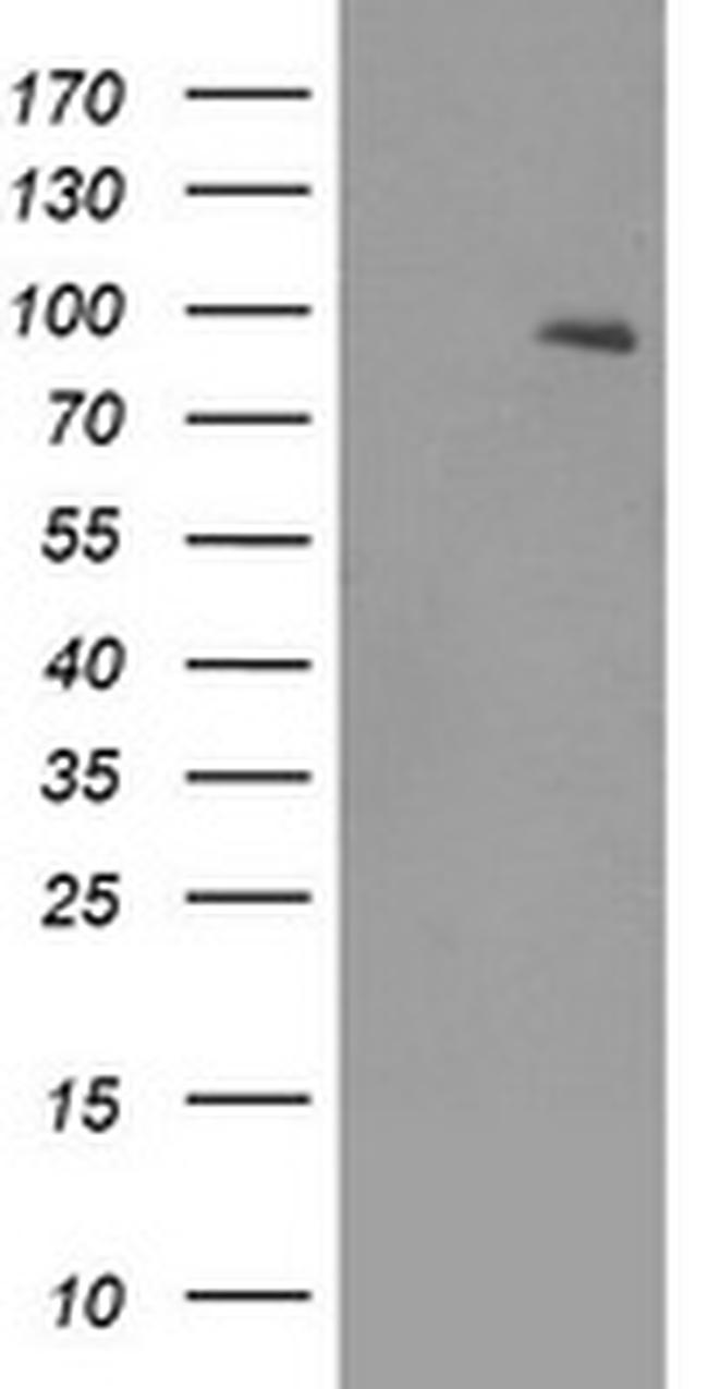 NTRK2 Antibody in Western Blot (WB)