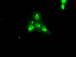 NTRK3 Antibody in Immunocytochemistry (ICC/IF)