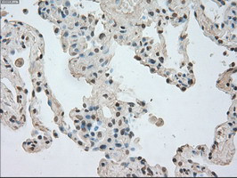 NTRK3 Antibody in Immunohistochemistry (Paraffin) (IHC (P))