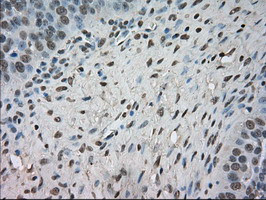 NTRK3 Antibody in Immunohistochemistry (Paraffin) (IHC (P))