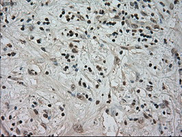 NTRK3 Antibody in Immunohistochemistry (Paraffin) (IHC (P))