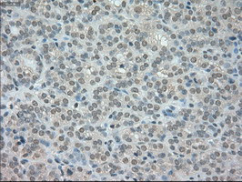 NTRK3 Antibody in Immunohistochemistry (Paraffin) (IHC (P))