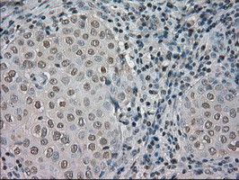 NTRK3 Antibody in Immunohistochemistry (Paraffin) (IHC (P))