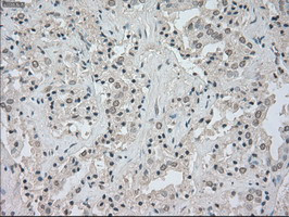 NTRK3 Antibody in Immunohistochemistry (Paraffin) (IHC (P))