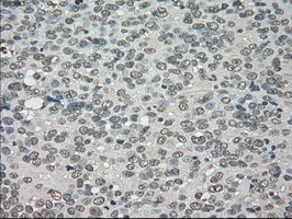 NTRK3 Antibody in Immunohistochemistry (Paraffin) (IHC (P))