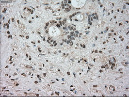 NTRK3 Antibody in Immunohistochemistry (Paraffin) (IHC (P))