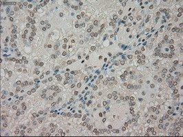 NTRK3 Antibody in Immunohistochemistry (Paraffin) (IHC (P))