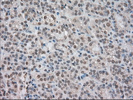 NTRK3 Antibody in Immunohistochemistry (Paraffin) (IHC (P))