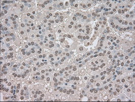 NTRK3 Antibody in Immunohistochemistry (Paraffin) (IHC (P))