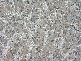 NTRK3 Antibody in Immunohistochemistry (Paraffin) (IHC (P))