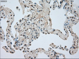 NTRK3 Antibody in Immunohistochemistry (Paraffin) (IHC (P))