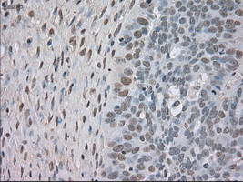 NTRK3 Antibody in Immunohistochemistry (Paraffin) (IHC (P))