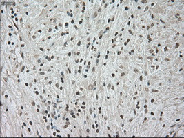 NTRK3 Antibody in Immunohistochemistry (Paraffin) (IHC (P))