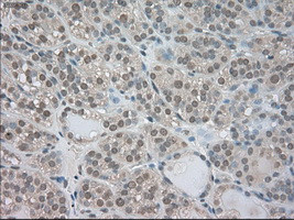 NTRK3 Antibody in Immunohistochemistry (Paraffin) (IHC (P))