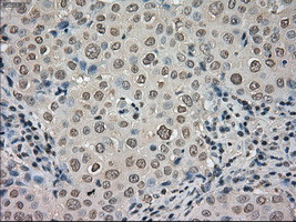 NTRK3 Antibody in Immunohistochemistry (Paraffin) (IHC (P))