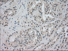 NTRK3 Antibody in Immunohistochemistry (Paraffin) (IHC (P))