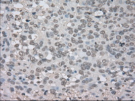 NTRK3 Antibody in Immunohistochemistry (Paraffin) (IHC (P))