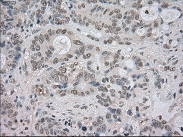 NTRK3 Antibody in Immunohistochemistry (Paraffin) (IHC (P))