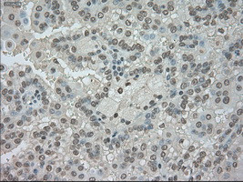 NTRK3 Antibody in Immunohistochemistry (Paraffin) (IHC (P))