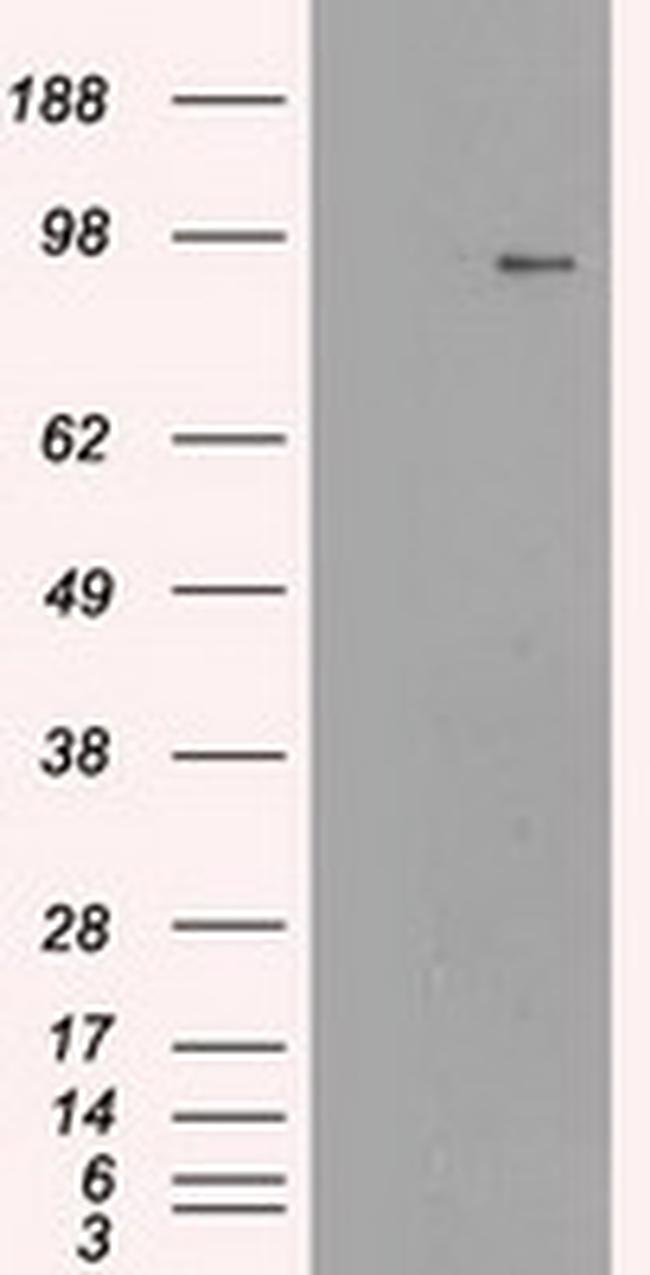 NTRK3 Antibody in Western Blot (WB)