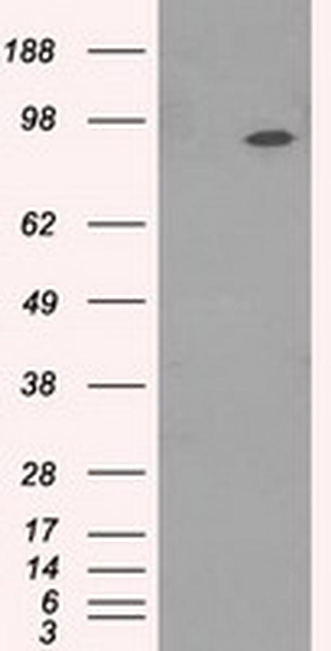 NTRK3 Antibody in Western Blot (WB)